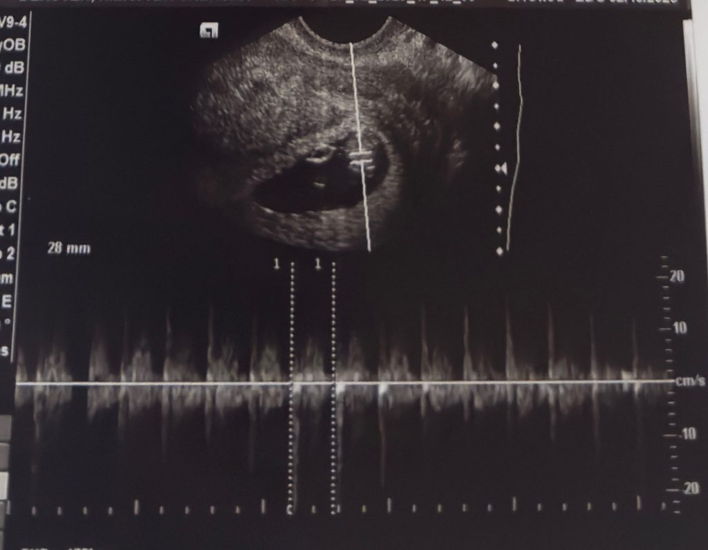 The first sonogram photo saved in my grandson's journal. keeping a journal for your grandchild
