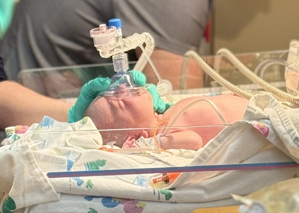 A newborn warming bed in the delivery room where Henry was given oxygen after birth.